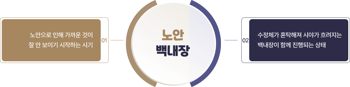 노안 백내장, 노안으로 인해 가까운 것이 잘 안 보이기 시작하는 시기, 수정체가 혼탁해져 시야가 흐려지는 백내장이 함께 진행되는 상태