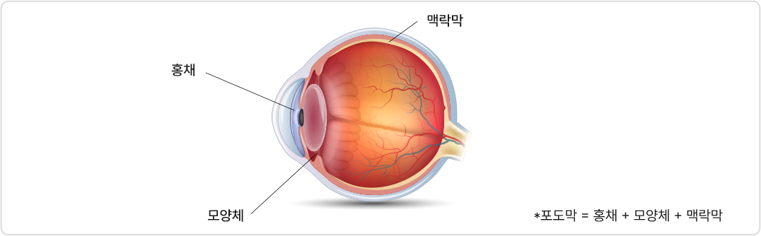 *포도막 = 홍채 + 모양체 + 맥락막