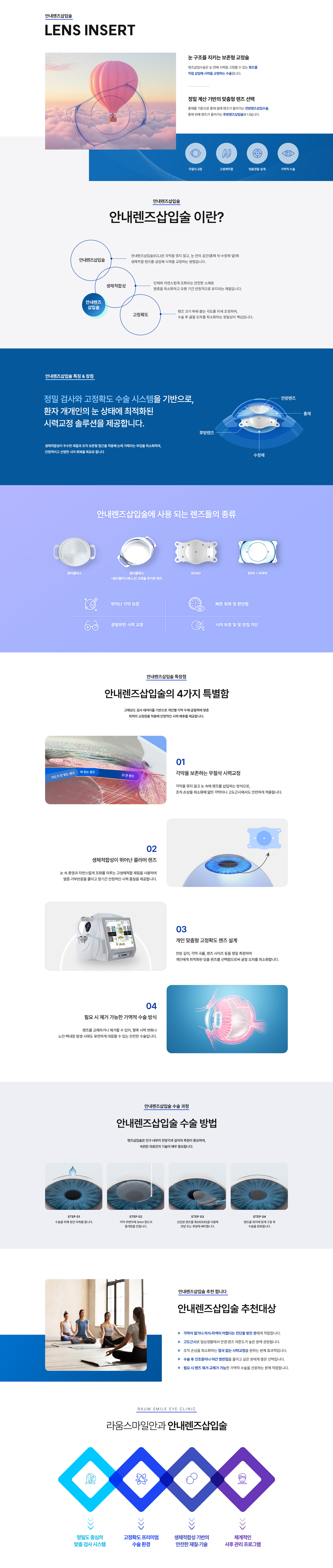 안내렌즈삽입술